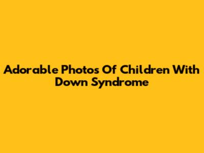 Adorable Photos Of Children With Down Syndrome