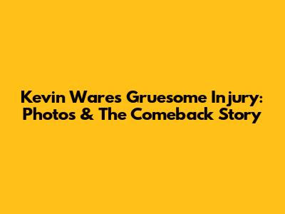 Kevin Ware's Gruesome Injury: Photos & The Comeback Story