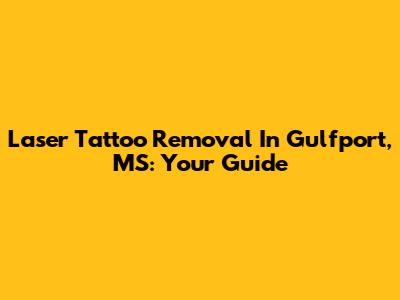 Laser Tattoo Removal In Gulfport, MS: Your Guide