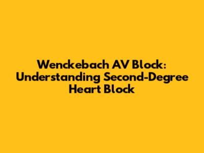 Wenckebach AV Block: Understanding Second-Degree Heart Block